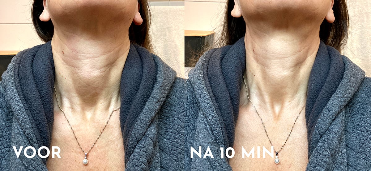 Rose of the Empress facelifting bundel